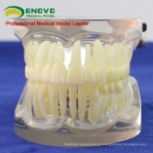 VENDER os dentes 12572 dentais humanos articulados do FE para o estudo do dente